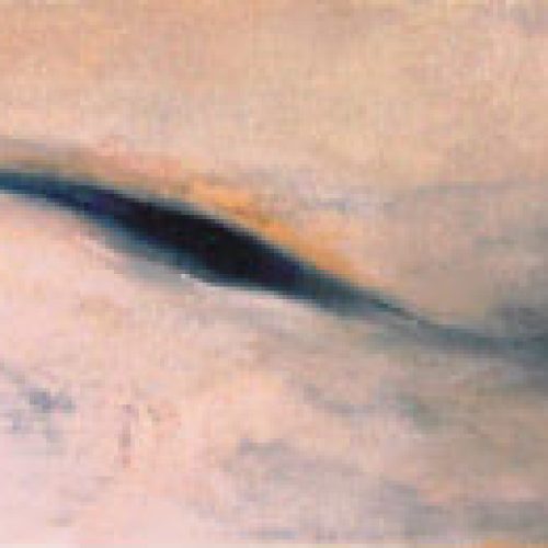 Herida, obra del artista José Moreno